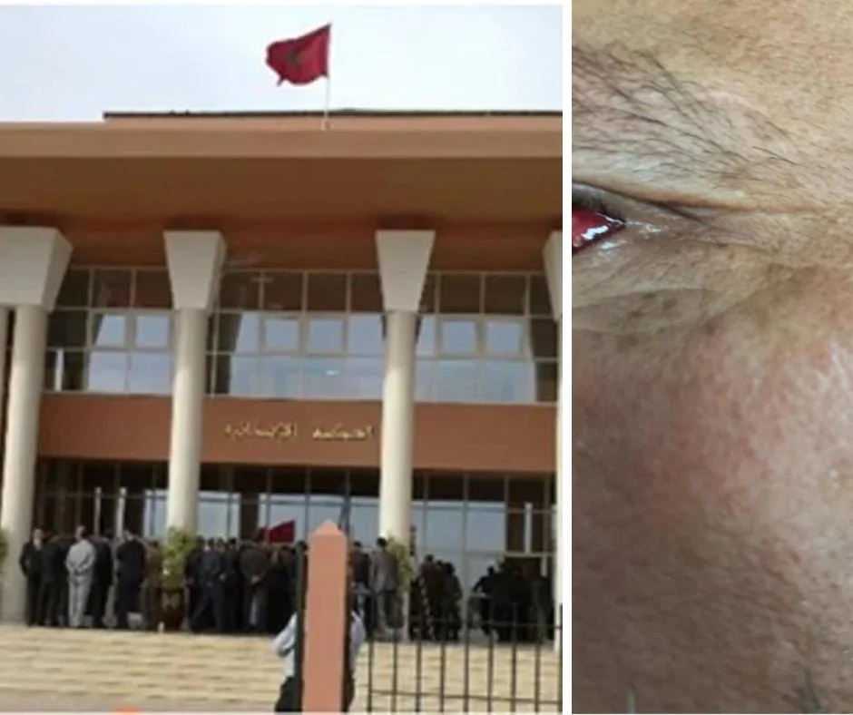 حجز قضية عوني سلطة متهمين بالاعتداء على صاحب عربة للمداولة بابن جرير