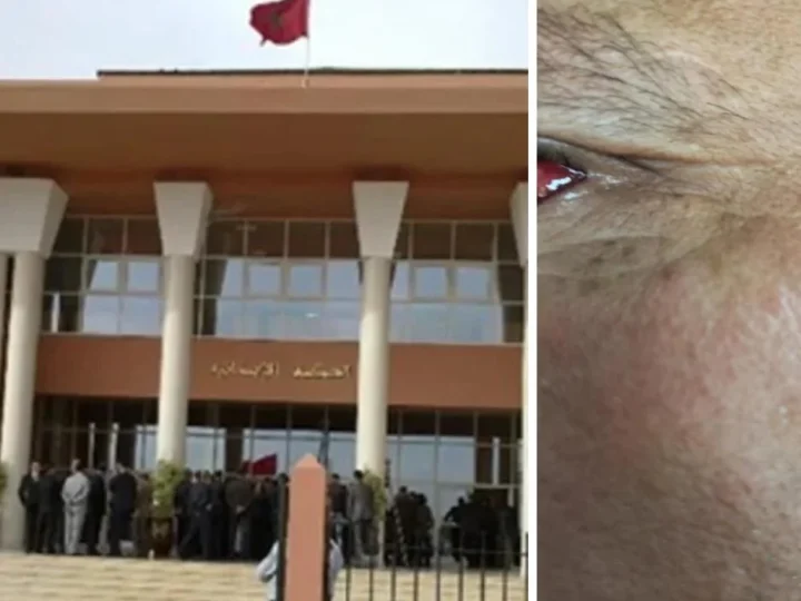 محاكمة عوني سلطة بـ”الاعتداء على صاحب عربة”..ابتدائية ابن جرير تأمر بخبرة طبية على الضحية